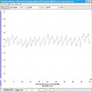 1991 Buick Regal, FP Waveform - iATN